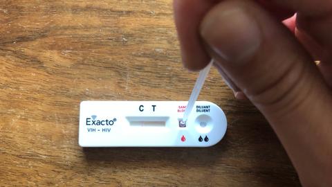 Was Ihr Uber Den Hiv Selbsttest Wissen Solltet You Fm Lifestyle